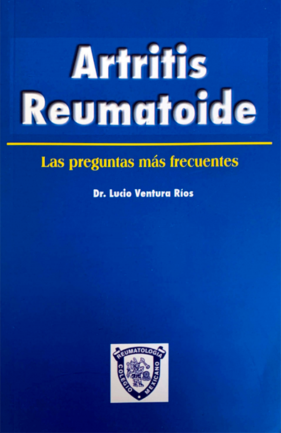 Osteoartritis.- las preguntas mas frecuentes