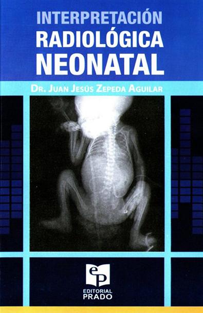 Interpretación radiologica neonatal