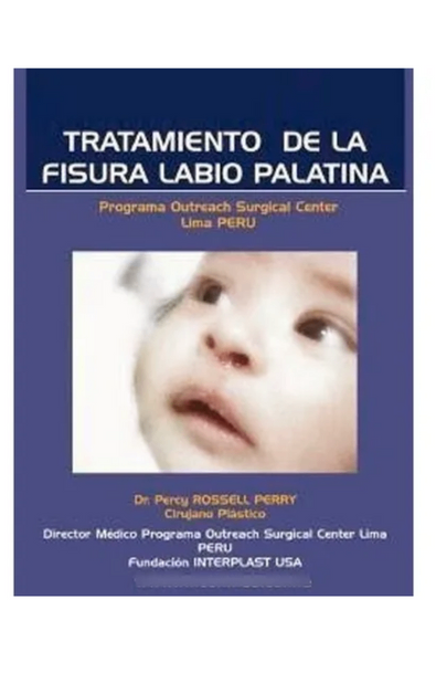 Tratamiento de la fisura labio palatina