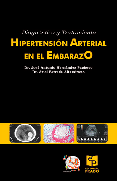 Diagnostico Y Tratamiento, Hipertension Arterial En El Embarazo
